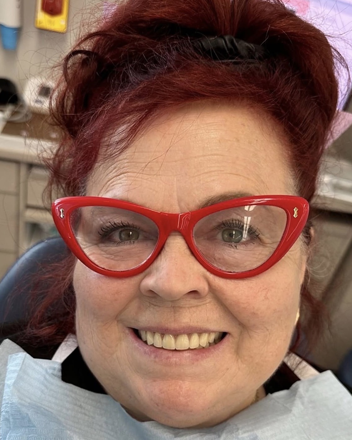 The same patient smiling after her new denture was fitted